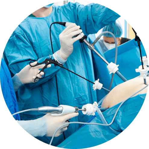 cirugia de hernia inguinal en merida